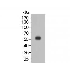 Anti-SerpinA6 antibody