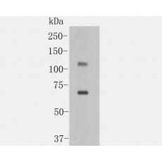 Anti-ACE2 antibody