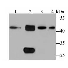 Anti-Cathepsin D antibody