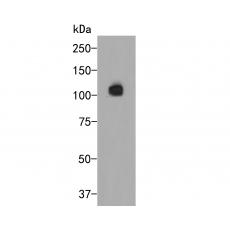 Anti-Smoothelin antibody