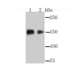 Anti-EGFR antibody