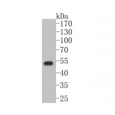 Anti-GABRD antibody