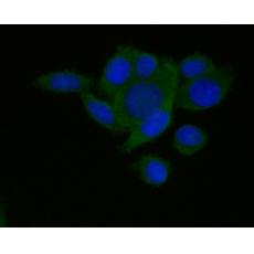 Anti-CD133 antibody