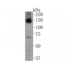 Anti-CD163 antibody