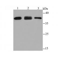 Anti-IREB2 antibody