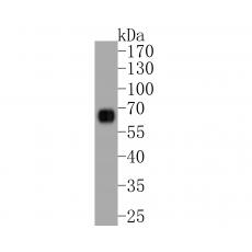 Anti-GSDMC antibody