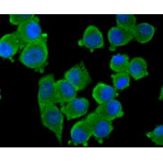 Anti-Tyrosine Hydroxylase antibody