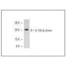 Anti-S100 beta antibody