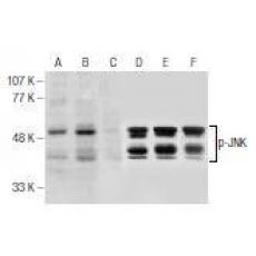 Anti-JNK antibody