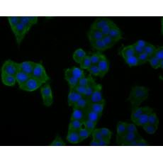 Anti-GM648 antibody