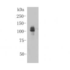 Anti-ITCH antibody