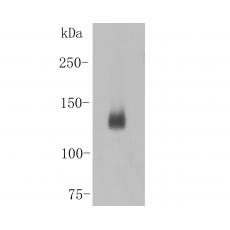 Anti-Desmoglein 3 antibody