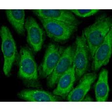 Anti-MGST1 antibody