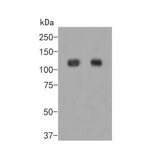 Anti-EPHA2 antibody