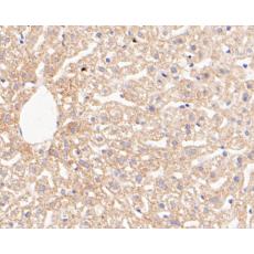 Anti-GLUD1 antibody