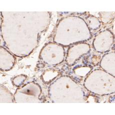 Anti-hNaa50p antibody