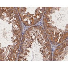 Anti-MST1 antibody