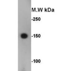Anti-CD56 antibody