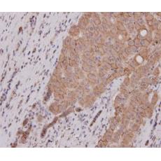 Anti-E-Cadherin antibody