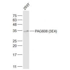 Anti-PAG608 antibody