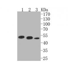 Anti-P2RX1 antibody