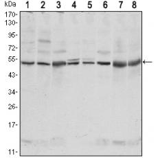 Anti-CSK antibody [F1-F3]