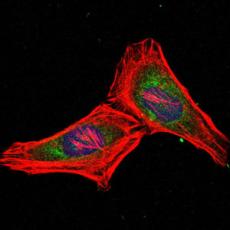 Anti-PSMB8 antibody [H2-A5]