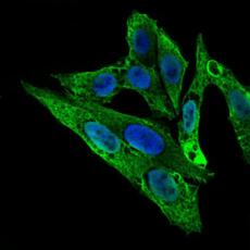 Anti-ARHGDIA antibody [G8-C3]