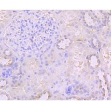 Anti-PCSK9 antibody [2F2]