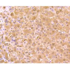 Anti-AKR1C1 antibody [5-F10]