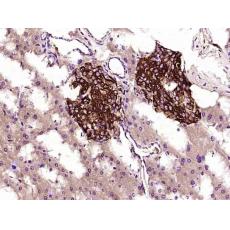 Anti-TIMP-1 antibody [4C2]