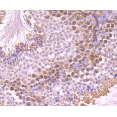 Anti-UAP1 antibody [4H1]