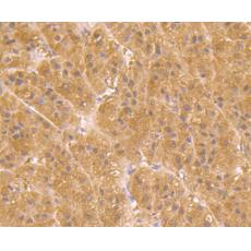 Anti-UGP2 antibody [7H1]