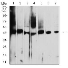 Anti-AUP1 antibody [1H6A1]