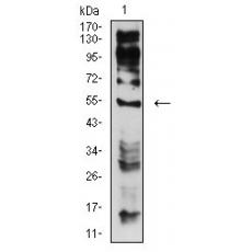 Anti-CHRNE antibody [5F11G8]