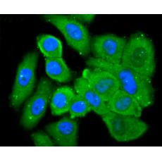 Anti-L-FABP antibody [AH54-31]