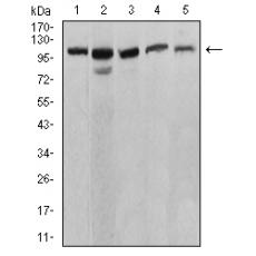 Anti-ATP2A1 antibody [H6-D1]