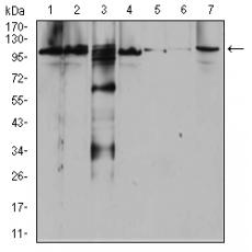 Anti-RAB11FIP1 antibody