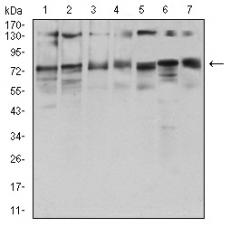 Anti-GFPT1 antibody