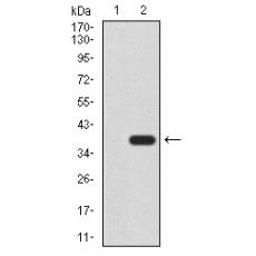 Anti-CK5 antibody [6D-4D]