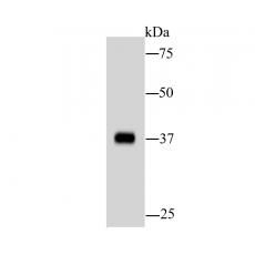 Anti-AKR7A2 antibody [C10-D5]