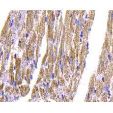 Anti-TNNT2 antibody [5-C7]