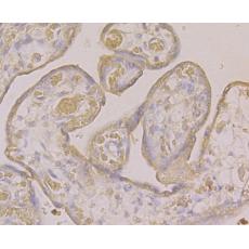 Anti-PLGF antibody [3G2]