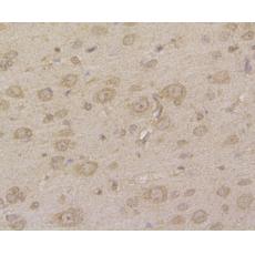 Anti-Hip1 antibody [13E1]