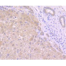 Anti-TPA antibody [AH81-00]