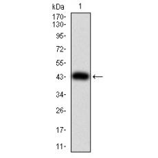 Anti-ULK2 antibody