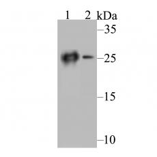 Anti-Carbonic anhydrase 2 antibody [11A2]