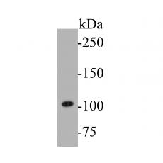 Anti-Dynamin 1 antibody [A1B2]