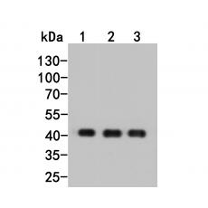 Anti-beta Actin (HRP conjugated) antibody [A2-F6]