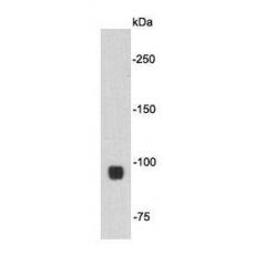 Anti-Beta-catenin antibody [10-C0-B7]